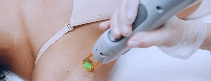 062870335431-laser-hair-removal-1-870x460-17207775841312.jpeg