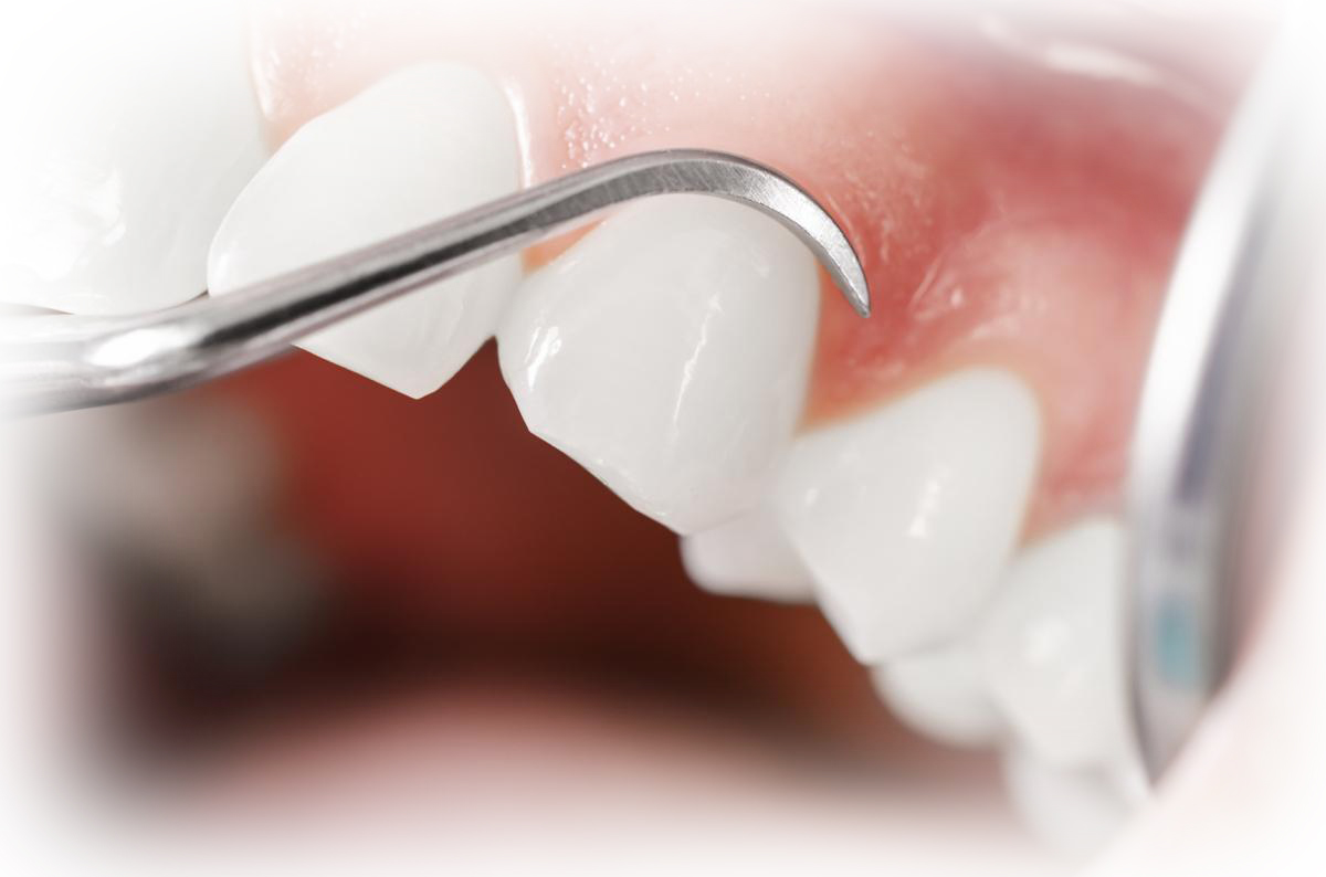 300-periodontal-therapy-1.jpg