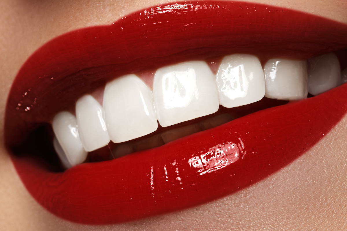 1461-hollywood-smile---5a521793cb94305825b4b4a90f1793f966487734.jpg