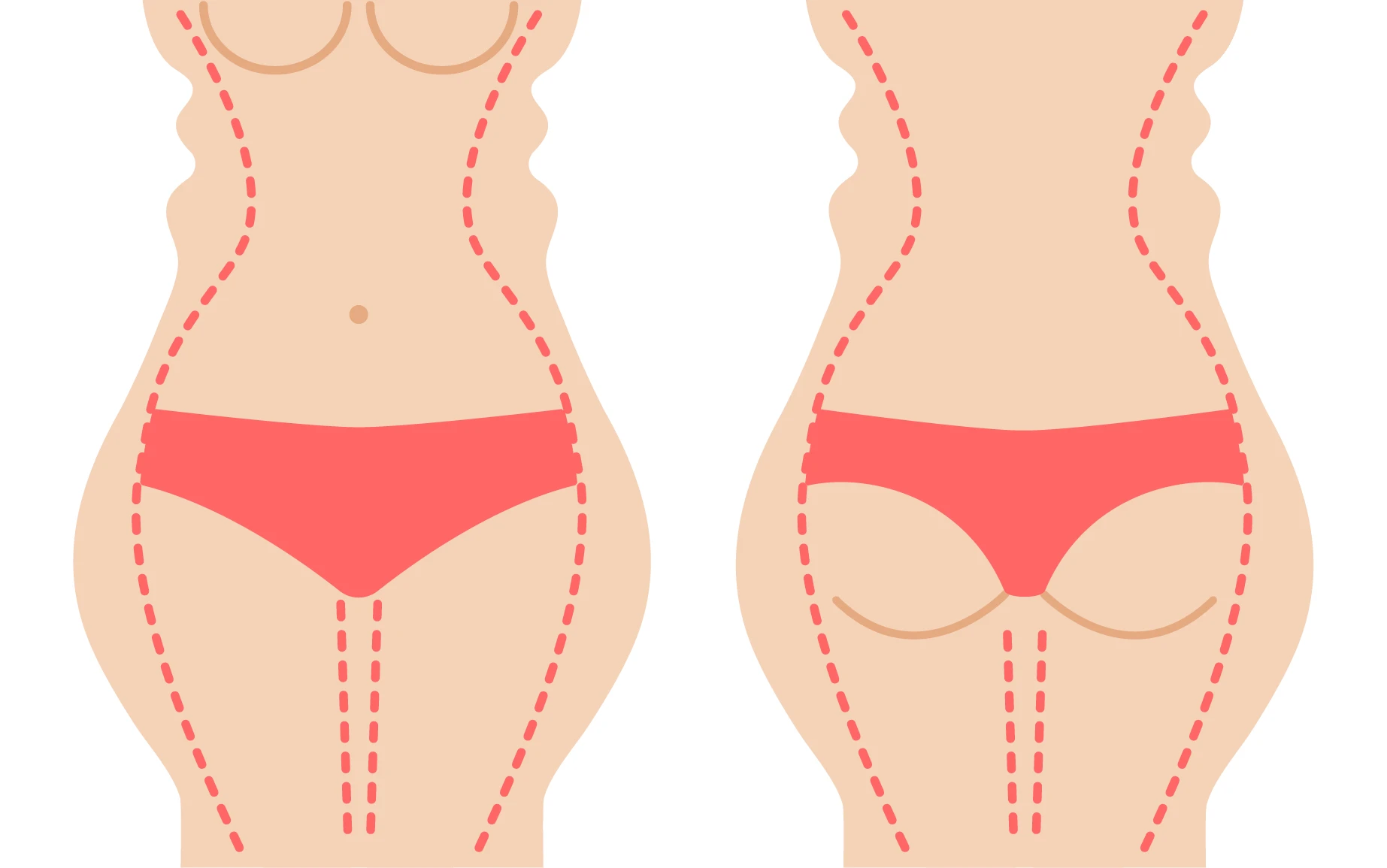 1773-body-contouring-image-16920987660432.png