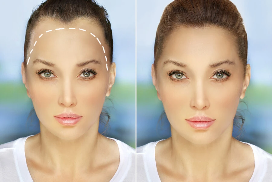 r980-women-hair-banner-17081611517.jpg
