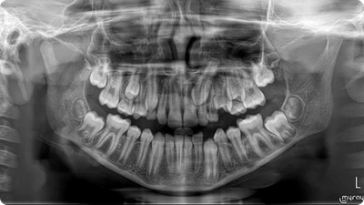 dentalna-panoramna-snimka