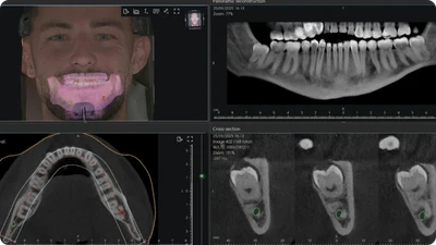 713-3d-svst-vitadent-1-1784560032775.png