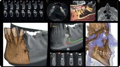 3D-CBCT-prilojeniya