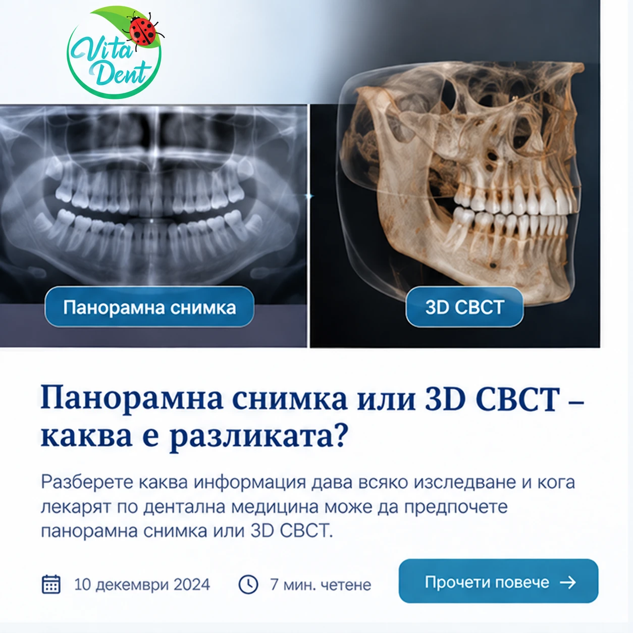 Панорамна снимка или 3D CBCT – каква е разликата?